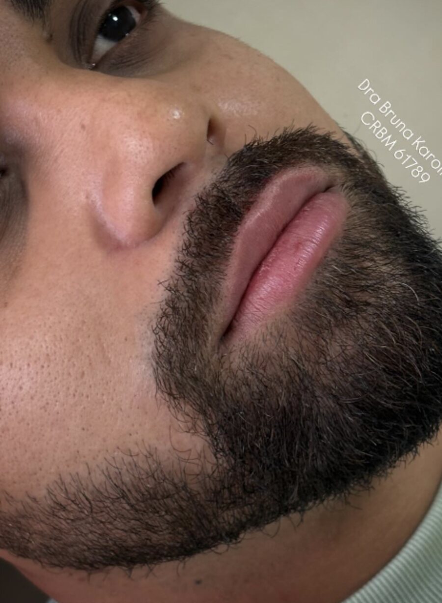 Contorno mandibular masculino