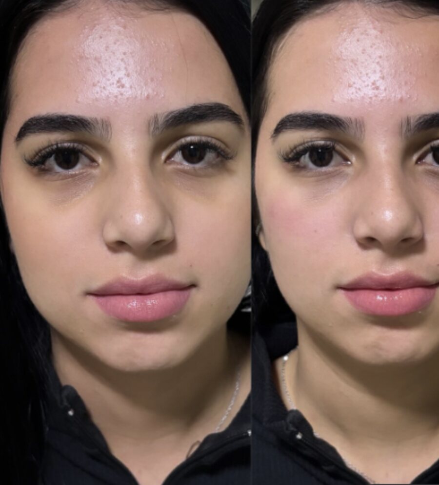 Skinbooster