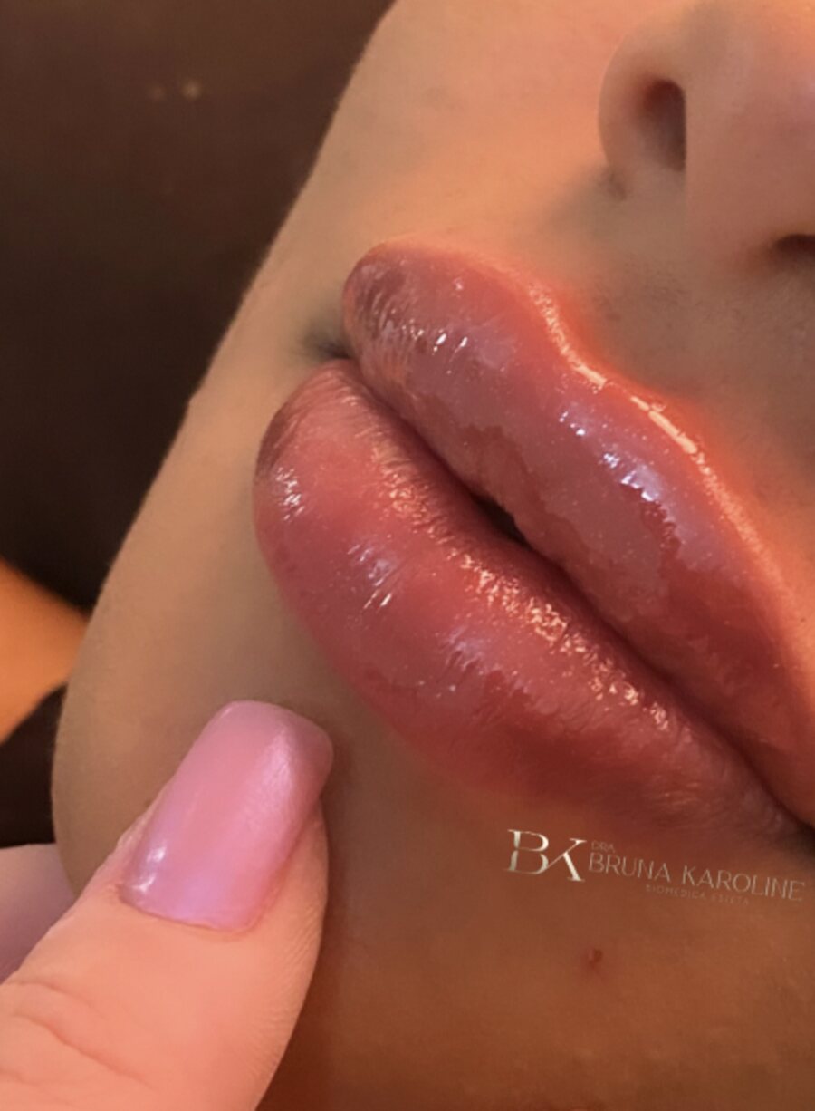 Hidratação labial